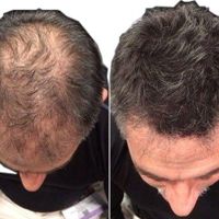 تونیک هیر فرند تضمینی|آرایشی، بهداشتی، درمانی|تهران, چیتگر|دیوار