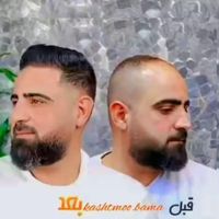 جشنواره کاشت مو 10 میلیون|خدمات آرایشگری و زیبایی|تهران, صادقیه|دیوار