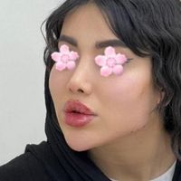 کلینیک تزریق ژل بوتاکس فیلر زیرچشم هایفولیزر انزیم|خدمات آرایشگری و زیبایی|کرج, گوهردشت|دیوار