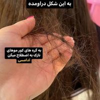 جشنواره موخوره تراپی و پاکسازی پوست|خدمات آرایشگری و زیبایی|قم, بنیاد|دیوار