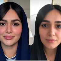 مطب پوست و مو و زیبایی|خدمات آرایشگری و زیبایی|تهران, سعادت‌آباد|دیوار