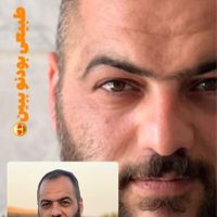 کاشت مو و‌یک جلسه مزوتراپی یک جلسه پی آر پی رایگان|خدمات آرایشگری و زیبایی|تهران, جردن|دیوار
