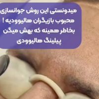 مطب زیبایی لیزر هایفو بوتاکس پلینیگ هالیوودی کربن|خدمات آرایشگری و زیبایی|تهران, پیروزی|دیوار