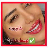 لمینیت کامپوزیت بریج و دندان مصنوعی و روکش|خدمات آرایشگری و زیبایی|تهران, آرژانتین|دیوار