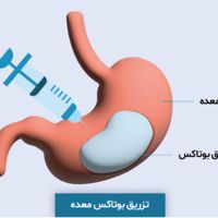 کاهش وزن اصولی و تضمینی|خدمات آرایشگری و زیبایی|تهران, سعادت‌آباد|دیوار