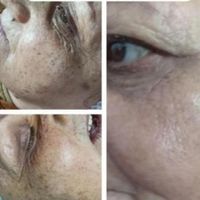 ازبین بردن کک ومک تضمینی در یک جلسه|خدمات آرایشگری و زیبایی|گالیکش, |دیوار