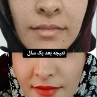 ازبین بردن کک ومک تضمینی در یک جلسه|خدمات آرایشگری و زیبایی|گالیکش, |دیوار