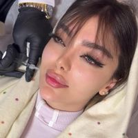 ژل لب روسی بوتاکس کانتورینگ و مادلینگ صورت لیفت نخ|خدمات آرایشگری و زیبایی|تهران, سعادت‌آباد|دیوار