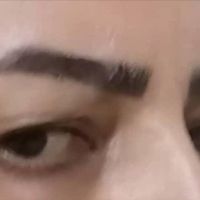 بلفاروبلاستی پلک بالا و پایین....اقساطی|خدمات آرایشگری و زیبایی|اصفهان, خوراسگان|دیوار