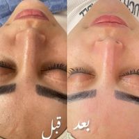 پاکسازی پوست و اموزش (تخصصی) همراه اصلاح صورت|خدمات آرایشگری و زیبایی|زنجان, |دیوار