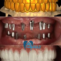 کلینیک تخصصی ایمپلنت دیجیتال/دندانپزشکی کاشت دندان|خدمات آرایشگری و زیبایی|تهران, پاسداران|دیوار