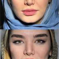 بوتکس،فیلر لب،ساکشن غبغب|خدمات آرایشگری و زیبایی|قدس, |دیوار