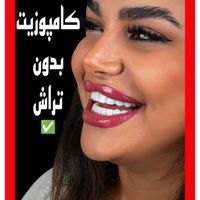 لمینیت کامپوزیت بریج و دندان مصنوعی و روکش|خدمات آرایشگری و زیبایی|تهران, آرژانتین|دیوار