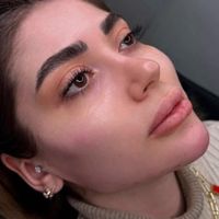 انجام خدمات زیبایی ژل و بوتاکس در کلینیک|خدمات آرایشگری و زیبایی|اصفهان, وحید|دیوار