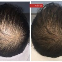 تونیک هیر فرند تضمینی|آرایشی، بهداشتی، درمانی|تهران, چیتگر|دیوار