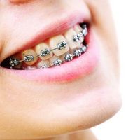 دندانپزشکی/ارتودنسی تخصصی|خدمات آرایشگری و زیبایی|تهران, خلیج فارس|دیوار