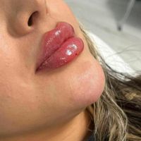آموزش ژل و بوتاکس. لیفت صورت بانخ (کلینیک)|خدمات آرایشگری و زیبایی|بندرعباس, |دیوار