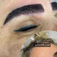 کاشت ابرو طبیعی و حرفه ای در کلینیک معتبر|خدمات آرایشگری و زیبایی|تهران, سهروردی|دیوار