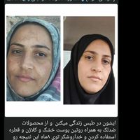 ارایشی زیبای ومراقبتی روتین روزانه|آرایشی، بهداشتی، درمانی|گالیکش, |دیوار