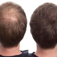 تونیک هیر فرند تضمینی|آرایشی، بهداشتی، درمانی|تهران, چیتگر|دیوار