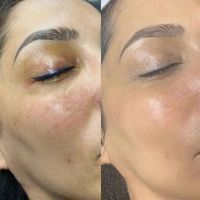 تخفیف ویژه مراجعه اول خدمات بهداشتی زیبایی|خدمات آرایشگری و زیبایی|اصفهان, قائمیه|دیوار