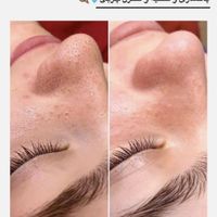 اخرین جایی ک برای پوستت میری اینجاست|خدمات آرایشگری و زیبایی|تهران, قلهک|دیوار