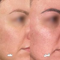 خدمات درمانی و زیبایی|خدمات آرایشگری و زیبایی|تهران, دروس|دیوار