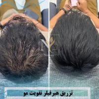 جشنواره یلدایی ژل،نخ،بوتاکس،فیلرلب ازسیصدهزارتومان|خدمات آرایشگری و زیبایی|تهران, نیاوران|دیوار