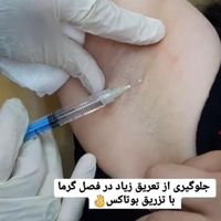 ‌ prp ولیزر مو زائد اسکلپیون آلمان بار درنجف آباد|خدمات آرایشگری و زیبایی|نجف‌آباد, |دیوار