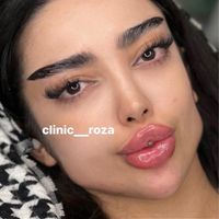مدل تزریق ژل فیلر کانتورینگ عربی لب روسی|خدمات آرایشگری و زیبایی|کرج, گوهردشت|دیوار