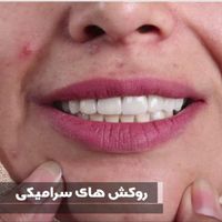 جشنواره خدمات دندانپزشکی به مدت محدود|خدمات آرایشگری و زیبایی|تهران, نارمک|دیوار