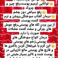 کرم ضد لک صورت معجزه با ضمانت مرجوعی|آرایشی، بهداشتی، درمانی|تهران, یافت‌آباد|دیوار