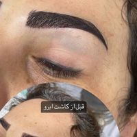 کاشت ابرو طبیعی و حرفه ای در کلینیک معتبر|خدمات آرایشگری و زیبایی|تهران, سهروردی|دیوار