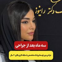 تخفیف ۱۰ میلیونی عمل جراحی بینی برای تاریخ ۱ بهمن|خدمات آرایشگری و زیبایی|تهران, مجیدیه|دیوار