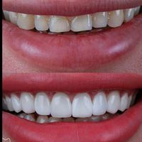 دندانپزشکی افسریه ارزان|خدمات آرایشگری و زیبایی|تهران, افسریه|دیوار