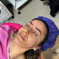 مرکز تخصصی بلفاروپلاستی|خدمات آرایشگری و زیبایی|تهران, سازمان برنامه|دیوار