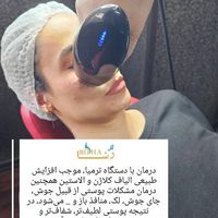 کیلینیک زیبایی روشا.افر یلدایی دهم دیماه|خدمات آرایشگری و زیبایی|تهران, پونک|دیوار