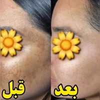 کرم ۸ کاره تضمینی|آرایشی، بهداشتی، درمانی|بندر امام خمینی, |دیوار