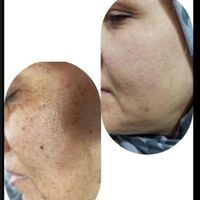 ازبین بردن کک ومک تضمینی در یک جلسه|خدمات آرایشگری و زیبایی|گالیکش, |دیوار