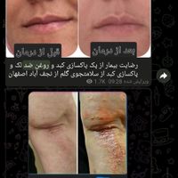 طب سنتی|آرایشی، بهداشتی، درمانی|تهران, قلمستان|دیوار