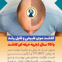 کاشت موی شیرازی|خدمات آرایشگری و زیبایی|تهران, سعادت‌آباد|دیوار