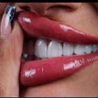 مرکز ایمپلنت و کامپوزیت با شرایط اقساط|خدمات آرایشگری و زیبایی|تهران, میرداماد|دیوار