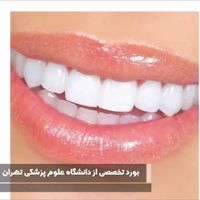 جشنواره خدمات دندانپزشکی به مدت محدود|خدمات آرایشگری و زیبایی|تهران, نارمک|دیوار