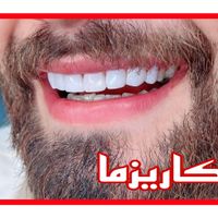 ایمپلنت عصبکشی روکش کامپوزیت ترمیم پوسیدگی دندان|خدمات آرایشگری و زیبایی|تهران, میدان ولیعصر|دیوار
