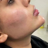 انجام خدمات زیبایی ژل و بوتاکس در کلینیک|خدمات آرایشگری و زیبایی|اصفهان, وحید|دیوار
