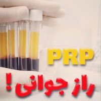 معجزه جوانسازی با پی آر پی در مطب|خدمات آرایشگری و زیبایی|قم, امام|دیوار