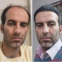 درمان ریزش مو و رویش مجدد کاملا تضمینی|خدمات آرایشگری و زیبایی|اصفهان, باغ زیار|دیوار