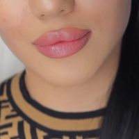 ژل لب روسی بوتاکس کانتورینگ و مادلینگ صورت لیفت نخ|خدمات آرایشگری و زیبایی|تهران, سعادت‌آباد|دیوار