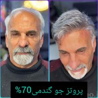 پروتزمو/ترمیم پروتزمو/روشی نوین جایگزین کاشت مو|خدمات آرایشگری و زیبایی|اصفهان, آفاران|دیوار
