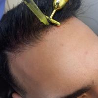 جشنواره تخصصی پی ار پی prp|خدمات آرایشگری و زیبایی|اصفهان, میرعماد|دیوار